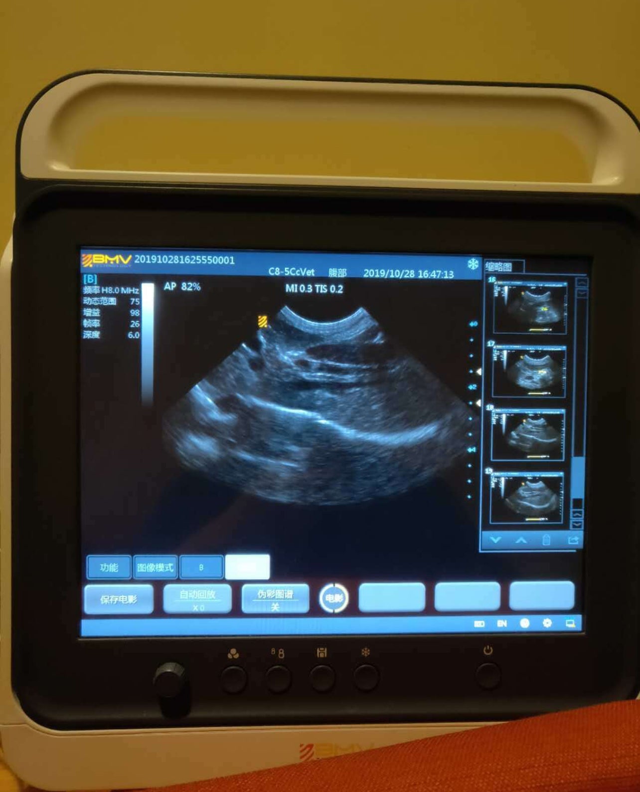 PT50A 15” Veterinary Touchscreen B/W Portable Ultrasound Scanner System
