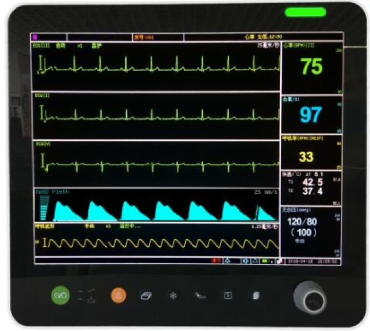UVM03CMP 15” Veterinary Multi-parameters Monitor with ECG RESP SpO2 NIBP TEMP PR Etco2 (Mainstream) Printer