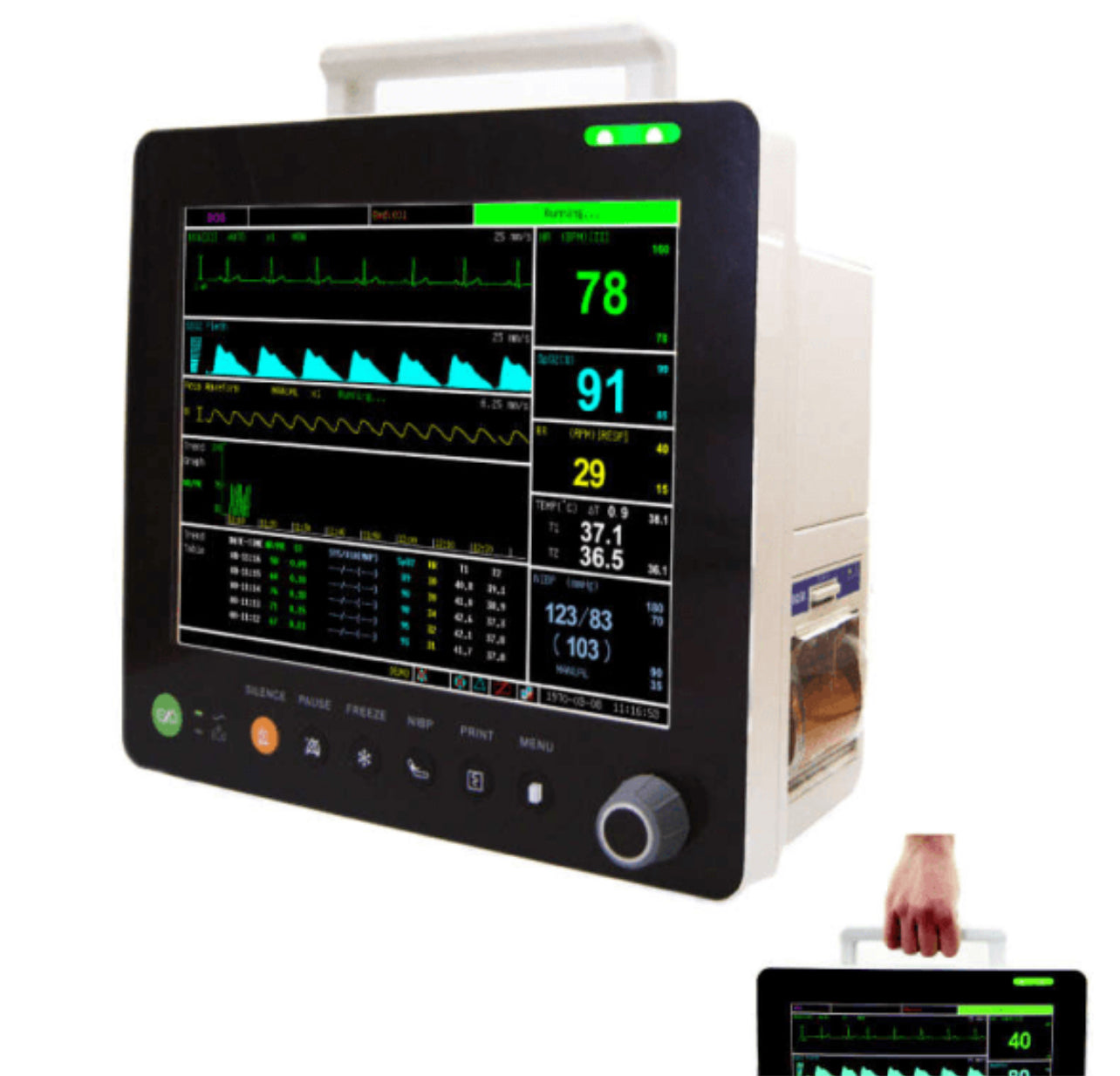 UVM03 15” Veterinary Multi-parameters Monitor with ECG RESP SpO2 NIBP TEMP PR