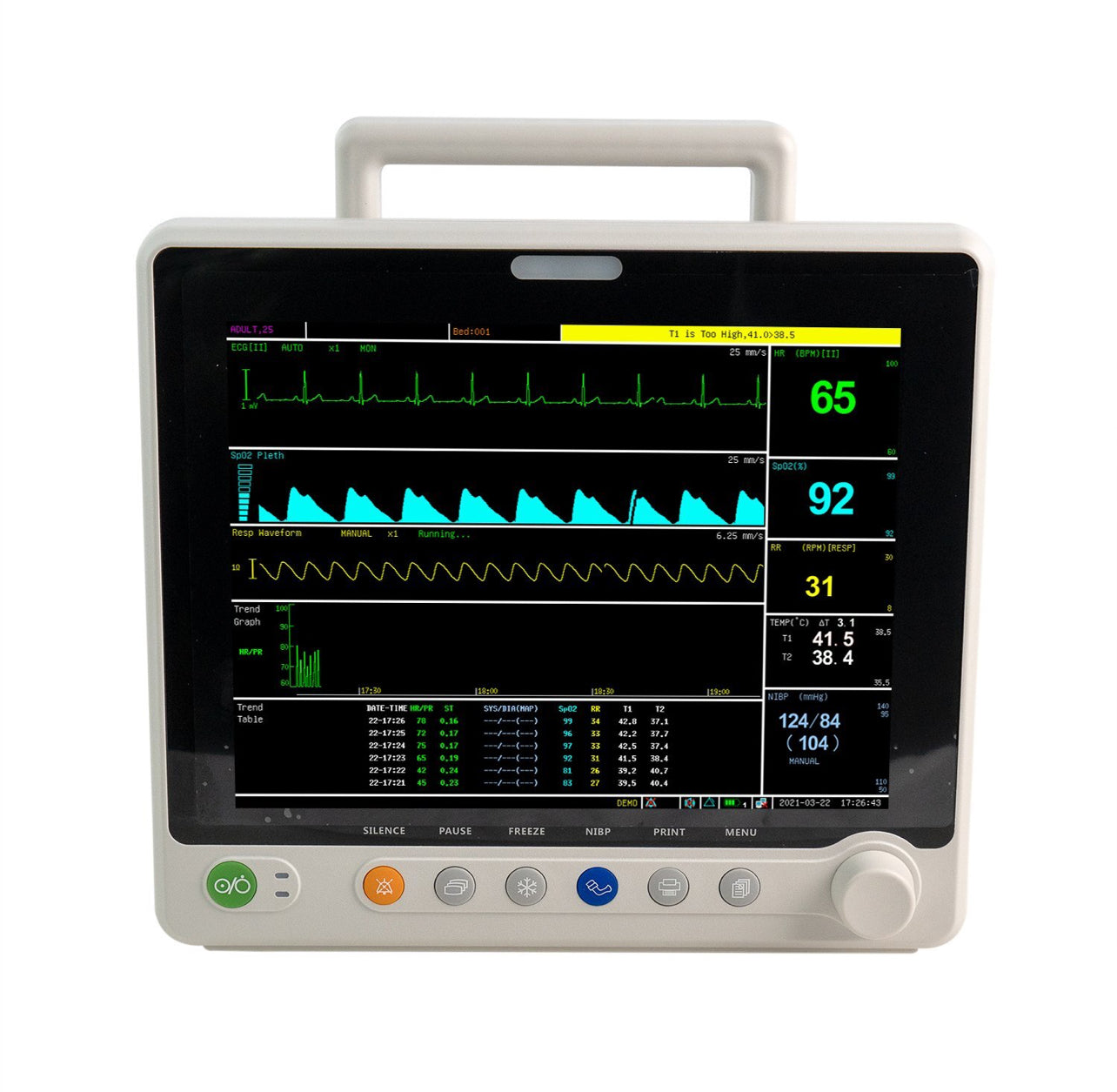 UVM02CMT 12” Touchscreen Veterinary Multi-parameters Monitor - ECG RESP SpO2 NIBP TEMP PR Etco2(Mainstream)