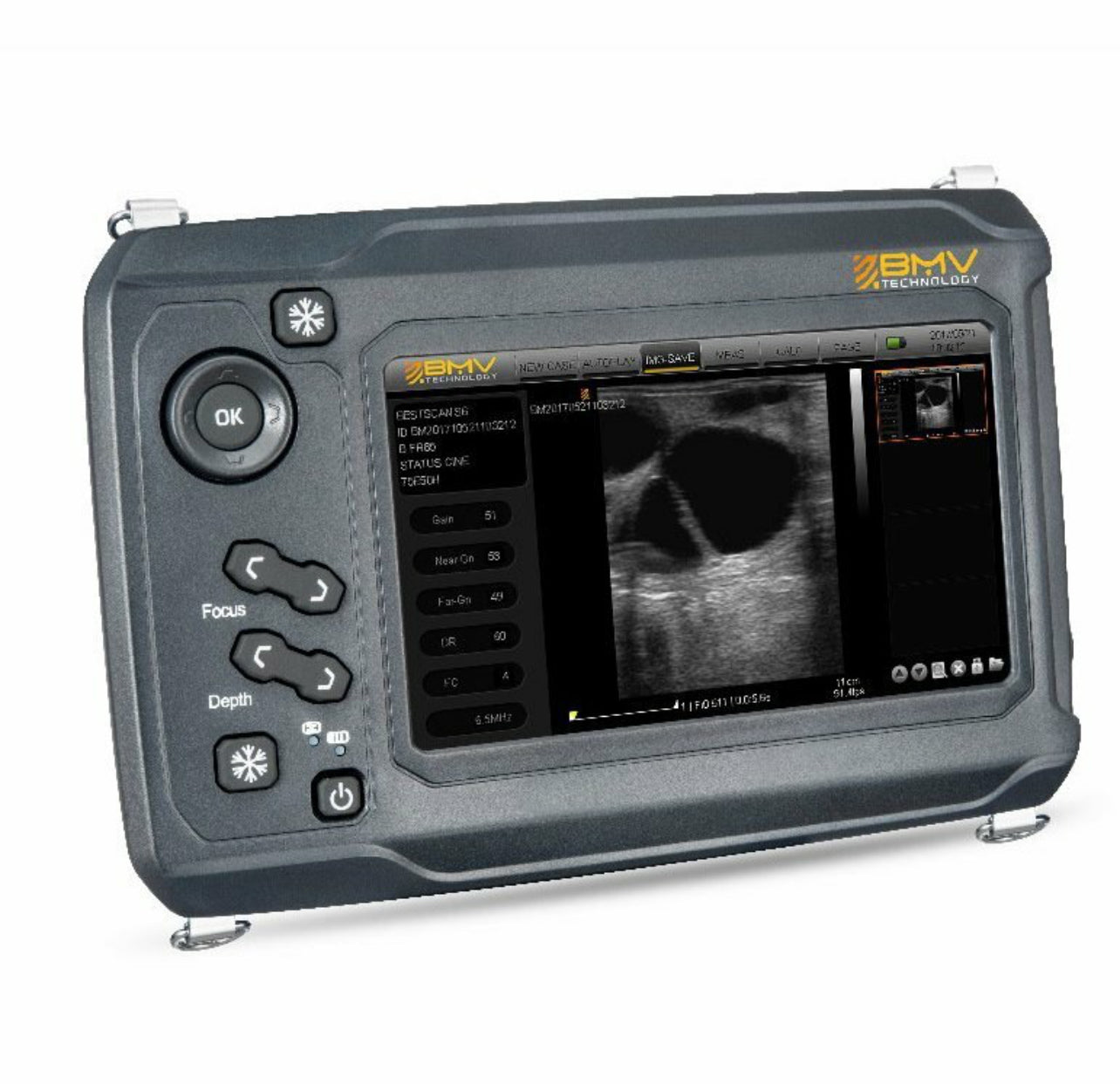Bestscan S6 Compact Touch Veterinary Ultrasound - Rapid on-farm large animal diagnosis