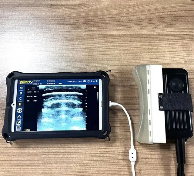 Bestscan S5 Plus Wireless Color Doppler Ultrasound System